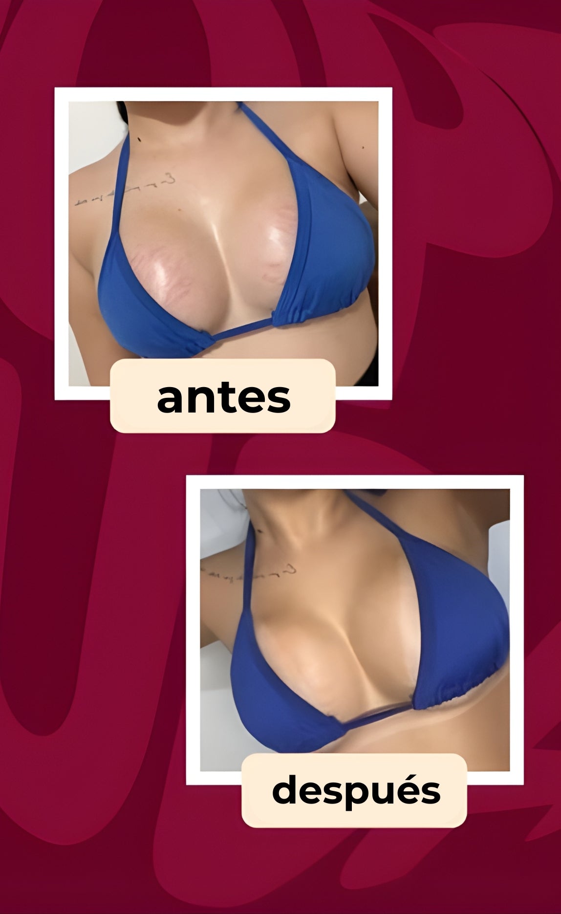 CREMA ALTIER DERMODELUXE POPOZUDA | Siente el cambio en los primeros días de uso