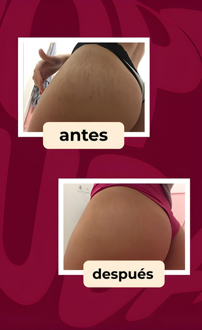 CREMA ALTIER DERMODELUXE POPOZUDA | Siente el cambio en los primeros días de uso