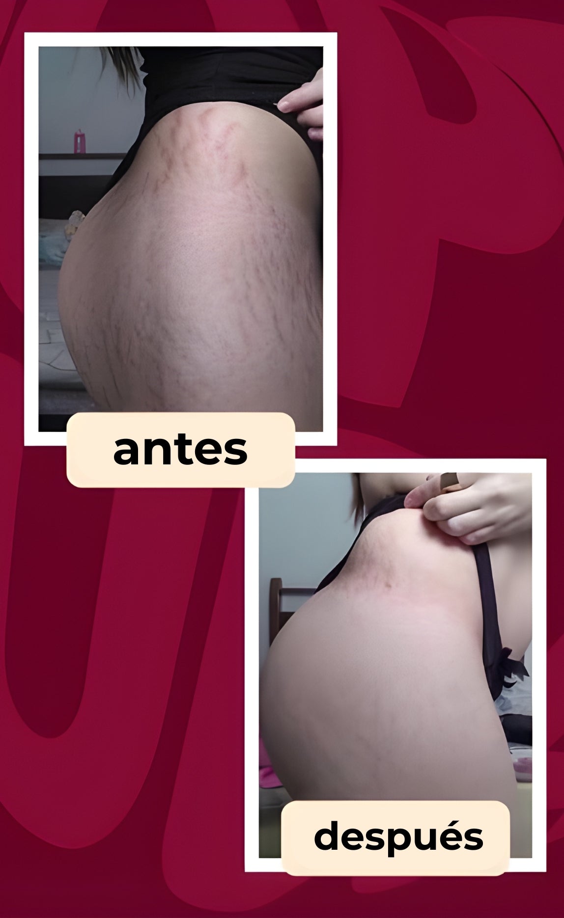 CREMA ALTIER DERMODELUXE POPOZUDA | Siente el cambio en los primeros días de uso