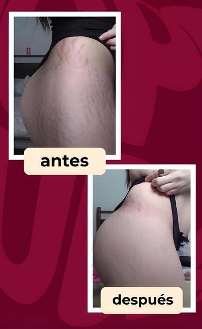 CREMA ALTIER DERMODELUXE POPOZUDA | Siente el cambio en los primeros días de uso