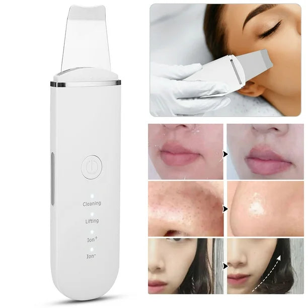 Limpiador Facial Peeling Ultrasónico + Serum de REGALO