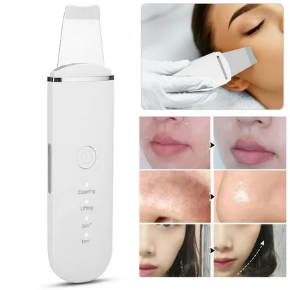 Limpiador Facial Peeling Ultrasónico + Serum de REGALO