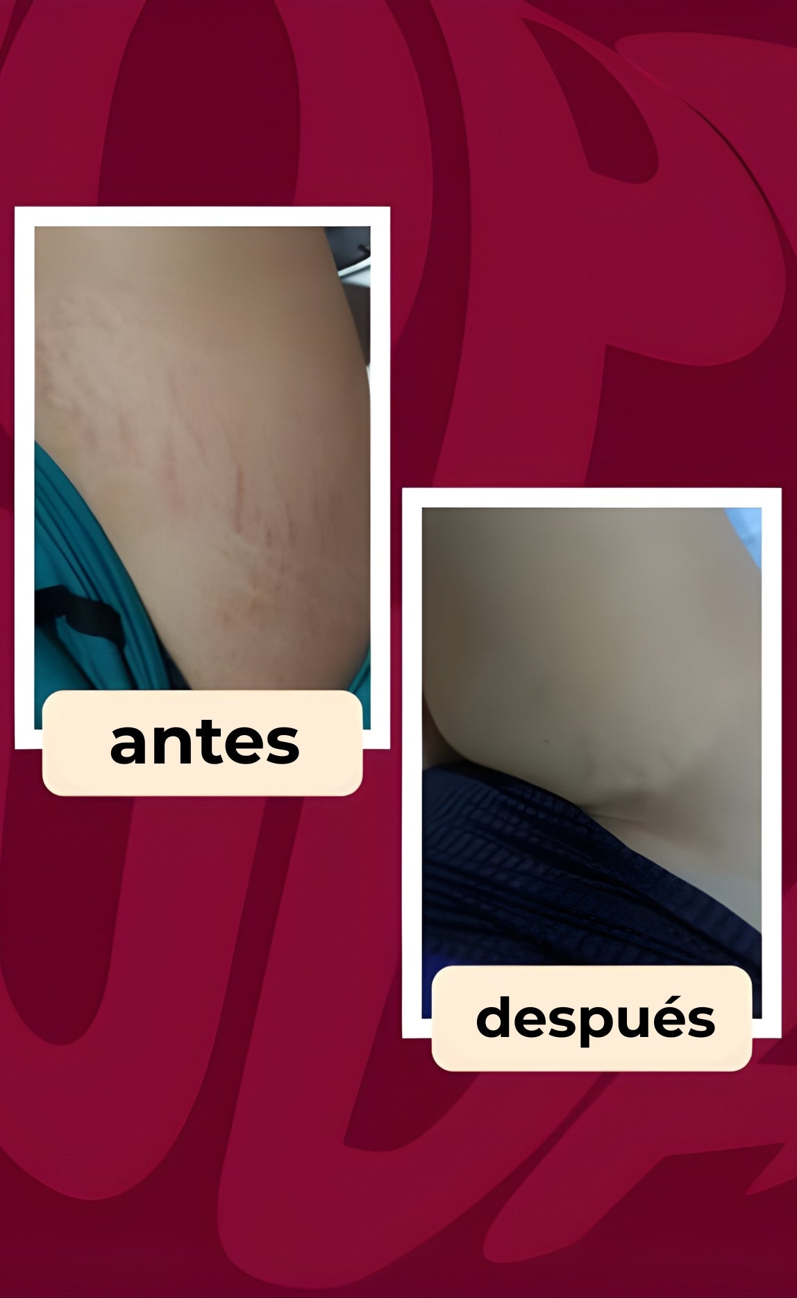 CREMA ALTIER DERMODELUXE POPOZUDA | Siente el cambio en los primeros días de uso