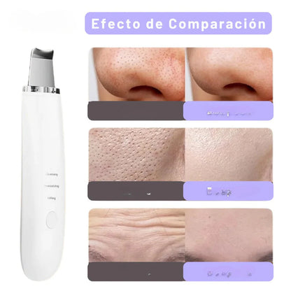Limpiador Facial Peeling Ultrasónico + Serum de REGALO